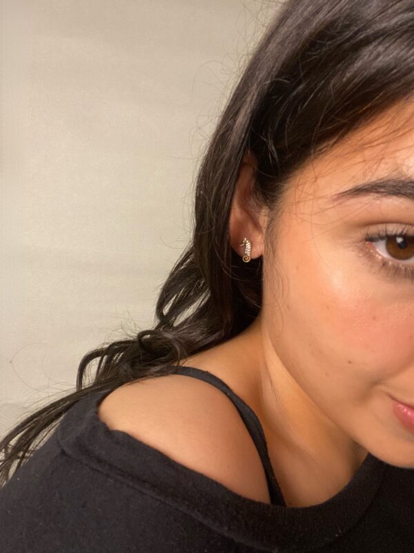 Aretes Hipocampo